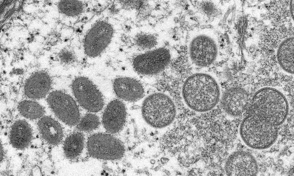 2022-05-19t105043z_1152629469_rc2t9u9tzxd0_rtrmadp_3_health-monkeypox-portugal-spain.jpg